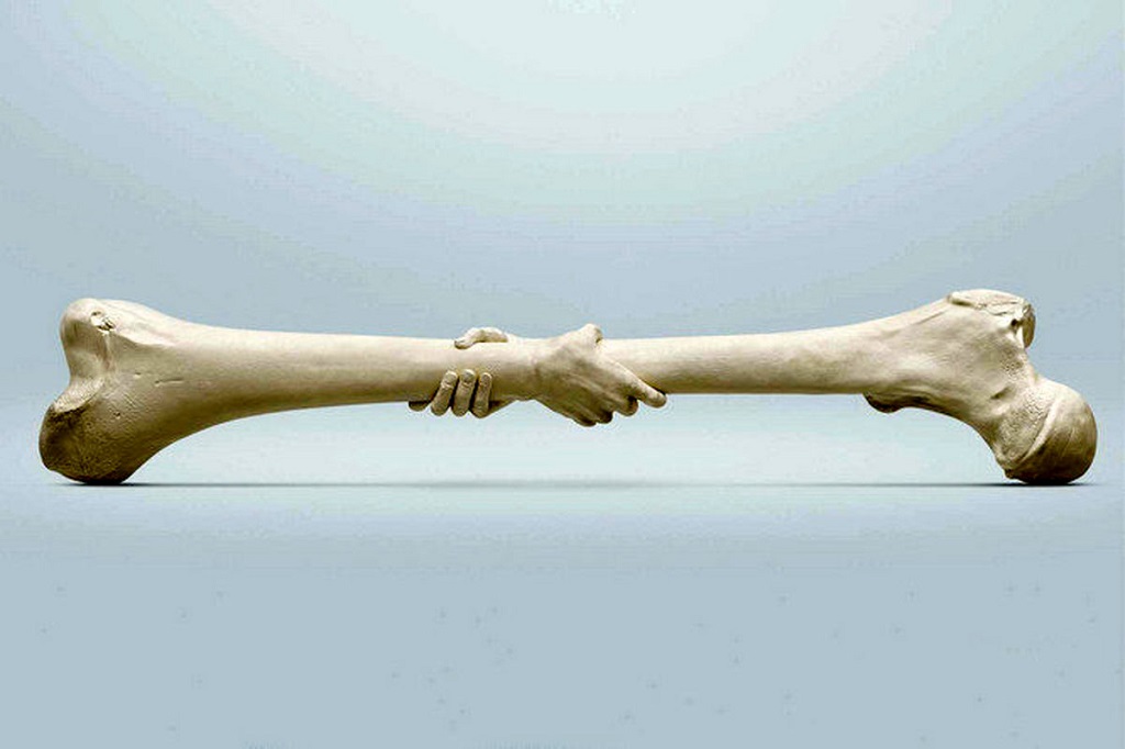 ۸۰ درصد زنان ایرانی بالای ۷۵ سال به پوکی استخوان مبتلا هستند